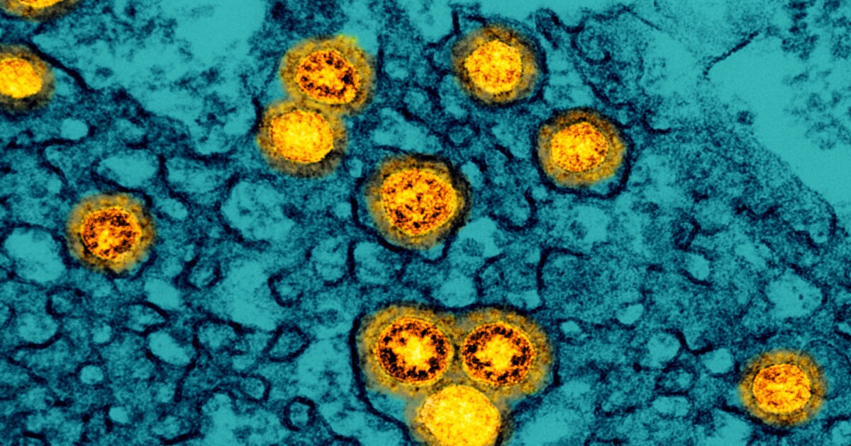 Omicron seen as milder coronavirus but scientists aren't sure